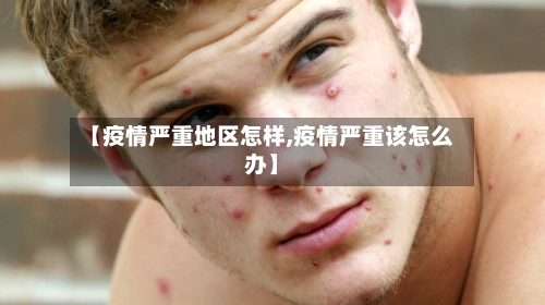 【疫情严重地区怎样,疫情严重该怎么办】-第2张图片